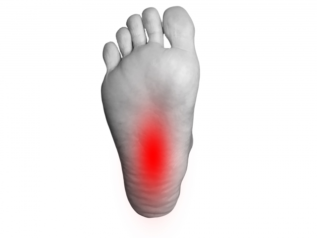 足底筋膜炎の基本的な知識